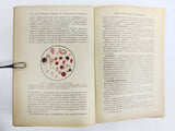 Antique 1912 Medical Blood Diseases Book by Dopter, 92 illustrations, Baillière