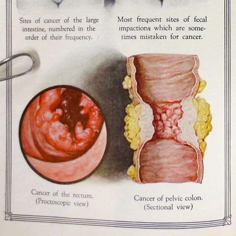 Vintage Standard Oil 1925 Advertising for Nujol Liquid Petrolatum Drug