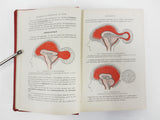Antique 1916 Medical Book on External Pathology by J. Okinczyc, 164 Drawings