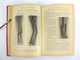 Antique 1921 Medical Book on External Pathology by P. Mathieu, 196 Drawings