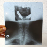 Vintage Genuine Medical X-Ray 8X9" of a Patient's Neck Cervical Vertebrae and Open Jaw, Human Skeleton X-Ray, Thick Blue Plastic Sheet